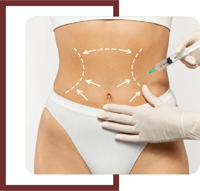 Mesoterapia Corporal Helen Dermoestética